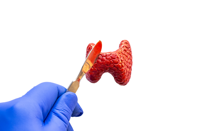 Thyroidectomy Surgery